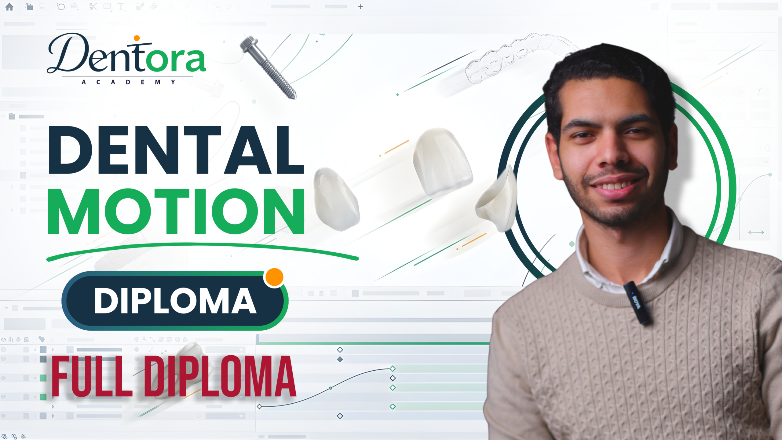 Full Dental Motion Diploma I Dr. Ahmed Sayed